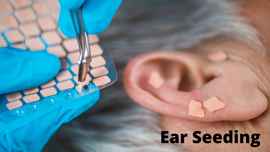 Exploring the World of Ear Seeds: A Needle-Free Journey into Acupuncture