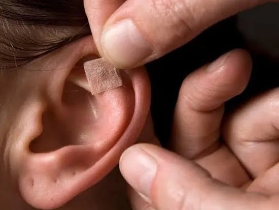 auriculotherapy and the benefits of acupuncture with ear seeds